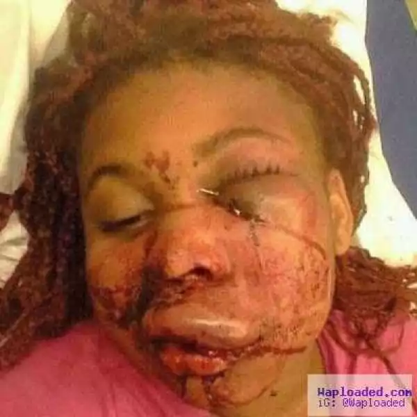 This Woman Is A Victim Of Domestic Violence